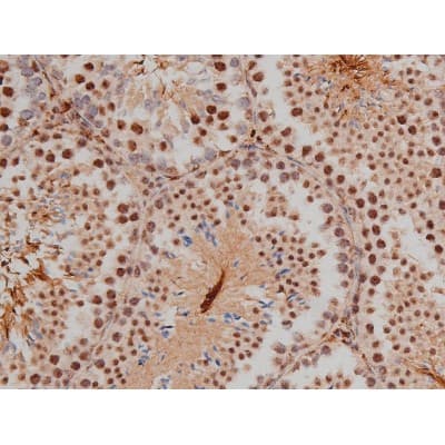 SP1 Antibody (phospho-Thr453)