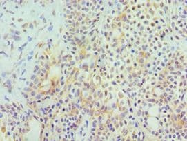 Polyclonal Rabbit anti-Human HYAL3 Antibody (aa198-417, IHC)