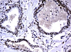 Monoclonal Mouse anti-Human PCNA Antibody (clone OTI1D11, IHC, WB)