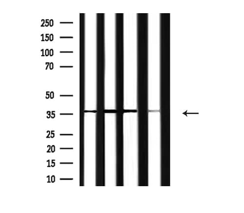 Polyclonal Rabbit anti-Human ANXA2 / Annexin A2 Antibody (IHC, WB)