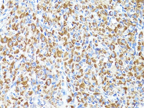 Polyclonal Rabbit anti-Human S100A10 Antibody (IHC, WB)
