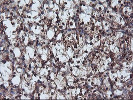 Monoclonal Mouse anti-Human NLN / Neurolysin Antibody (clone OTI3H4, IHC, WB)