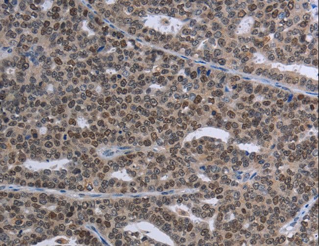 MAGEC1 Antibody