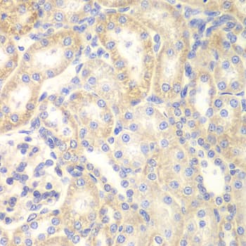 DLC1 Antibody
