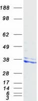 Human NUDT6 Protein (Recombinant Myc-DDK (Flag))
