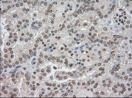 BUB1B / BubR1 Antibody (clone OTI3C7)