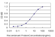 IHC-plus™ RTKN / Rhotekin Antibody (clone 2E5)