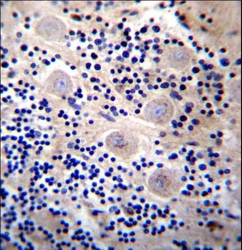 Polyclonal Rabbit anti-Human REPS2 Antibody (aa153-182, IHC, WB)