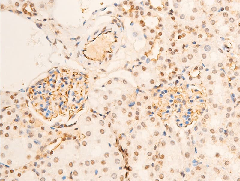 Polyclonal Rabbit anti-Human NTRK1 / TrkA Antibody (phospho-Tyr680,phospho-Tyr681, IHC, WB)
