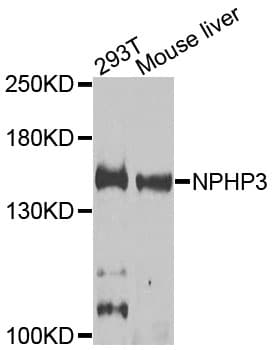 NPHP3 Antibody
