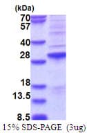 Human SSX2 Protein (Recombinant His)