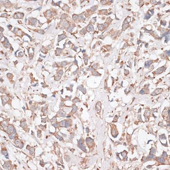 KDM8 / JMJD5 / FLJ13798 Antibody