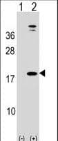 Leptin Antibody (aa8-37)