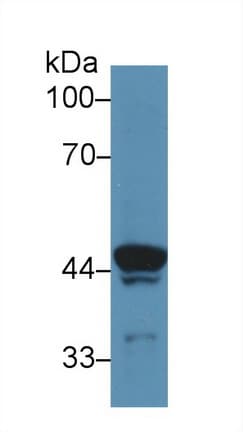 ATP6AP2 / Renin Receptor Antibody (aa18-302)