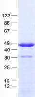 Human PDX1 Protein (Recombinant His, N-Terminal)