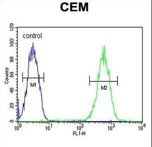 Polyclonal Rabbit anti-Human Delta-6 Desaturase / FADS2 Antibody (aa96-122, IHC, WB)