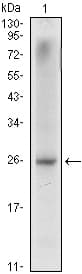 IHC-plus™ NKX3-1 Antibody (clone 4H4)