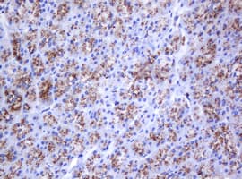 GLB1 / Beta-Galactosidase Antibody (clone OTI1C9)