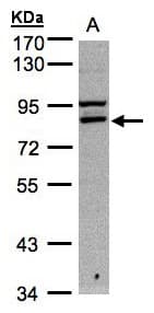 Polyclonal Rabbit anti-Human FASTKD1 Antibody (aa461-847, WB)