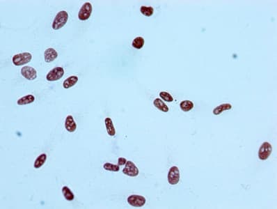 HIST1H2AB Antibody