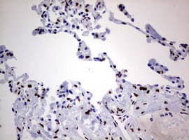 ZEB2 / SIP-1 Antibody (aa1-350, clone OTI1E12)