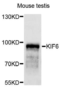 Polyclonal Rabbit anti-Human KIF6 Antibody (WB)