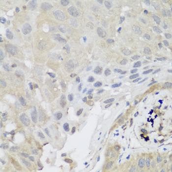 SH3GLB2 / Endophilin-B2 Antibody