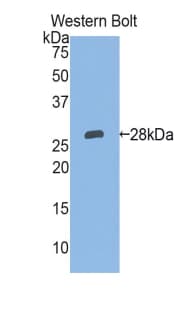 ITGA2 / CD49b Antibody (aa74-277)