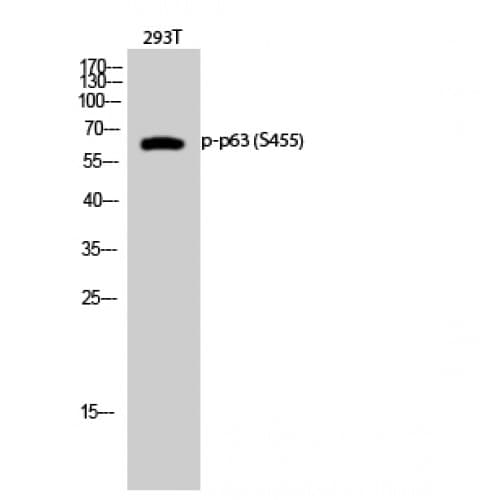 AMACR / P504S Antibody (390-470 aa)