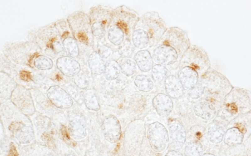 Polyclonal Rabbit anti-Human GBF1 Antibody (aa1809-1859, IHC, WB)