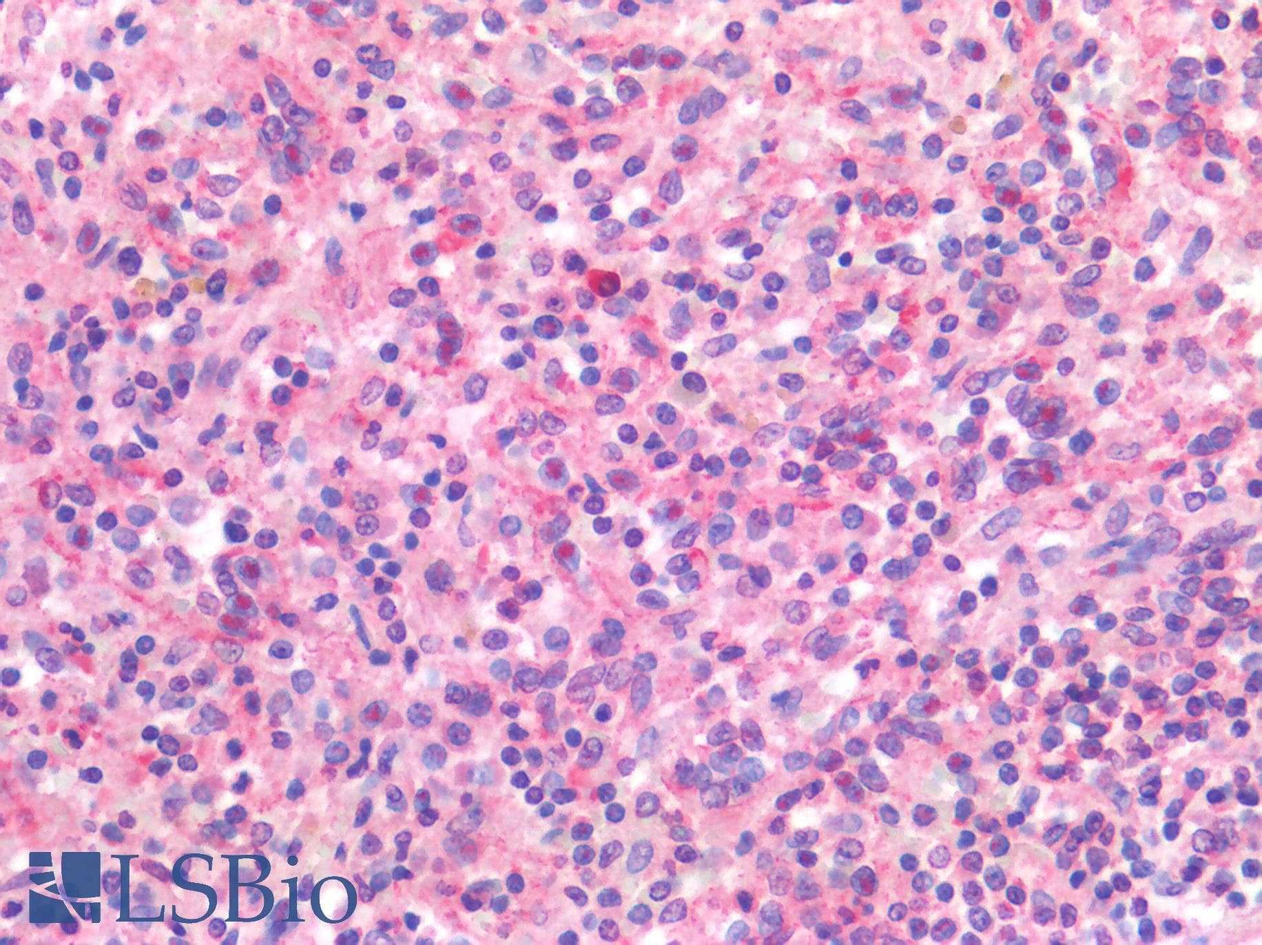 IHC-plus™ Polyclonal Rabbit anti-Human ITGAM / CD11b Antibody (IHC)
