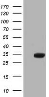 ERCC1 Antibody (clone OTI3E1)