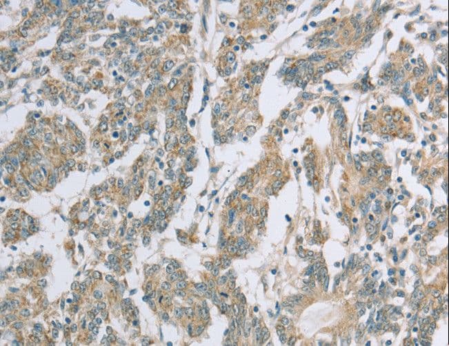 EDA2R / XEDAR Antibody
