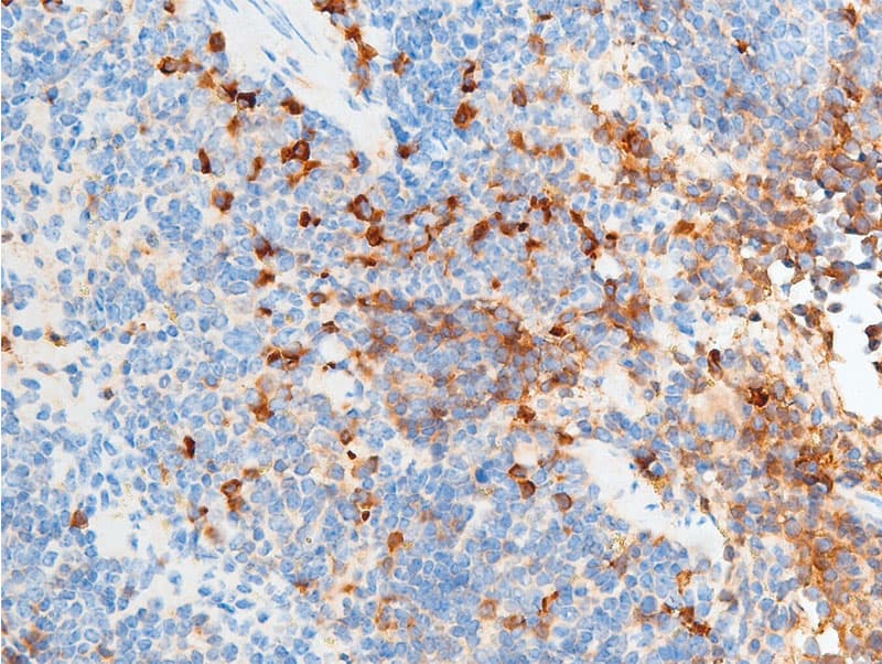 CHEK2 / CHK2 Antibody (phospho-Ser516)