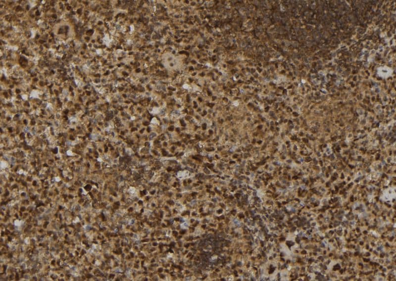 CALB1 / Calbindin Antibody
