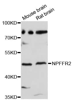 Polyclonal Rabbit anti-Human NPFF2 / NPFFR2 Antibody (WB)