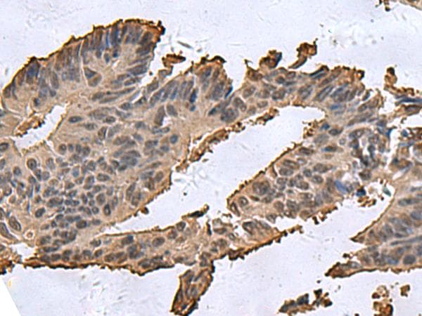 DCTPP1 / XTP3TPA Antibody