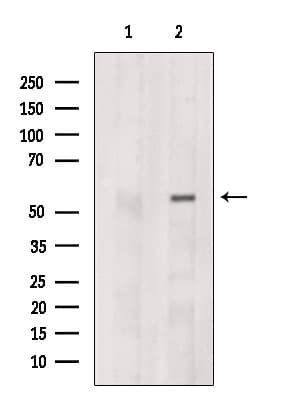 Polyclonal Rabbit anti-Human CCT6B Antibody (WB)