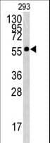 BTBD1 Antibody (aa295-322)