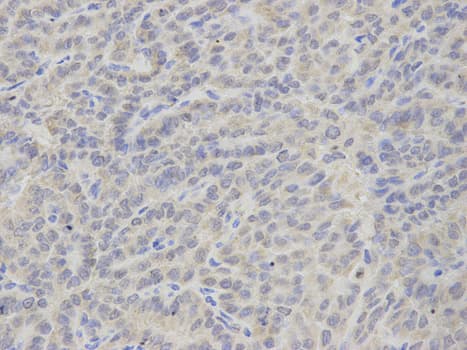 IHC-plus™ TS / Thromboxane Synthase Antibody