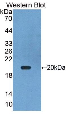 TNFSF13 / APRIL Antibody (aa105-250)