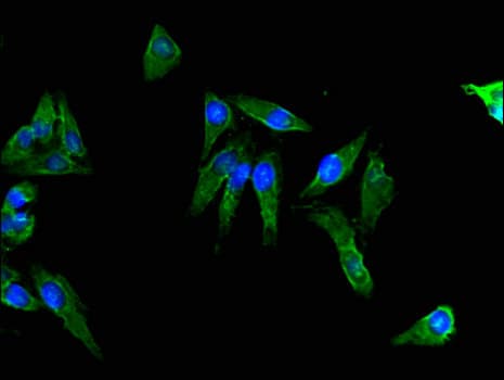 ACTG1 / Gamma Actin Antibody