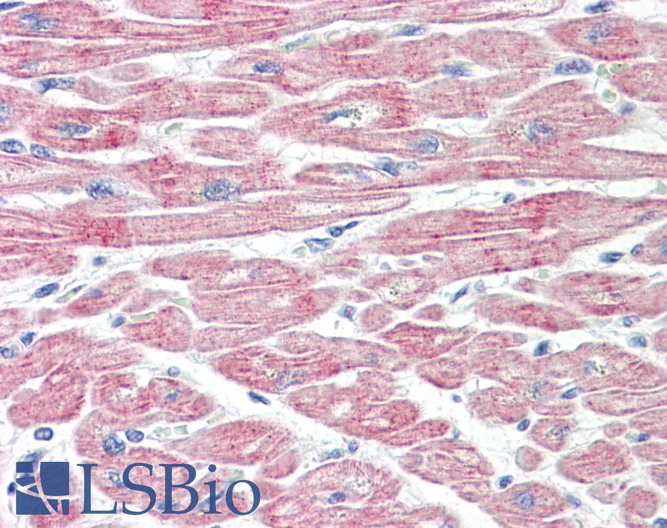 IHC-plus™ MPRIP / RIP3 Antibody (aa723-772)