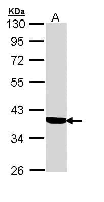 SERPINA6 / CBG Antibody (aa105-353)