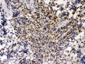 SPI1 / PU.1 Antibody