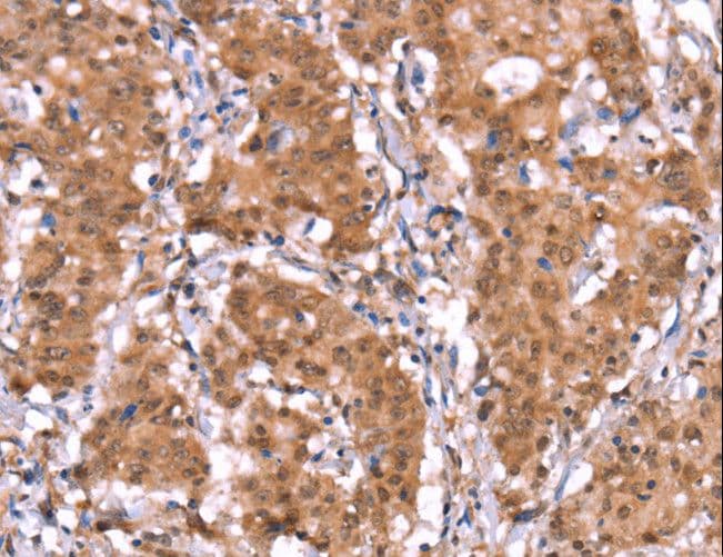 Polyclonal Rabbit anti-Human FAM123B / WTX Antibody (IHC)