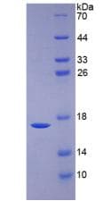 Human BMP6 Protein (Recombinant His)