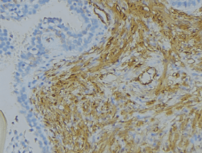 Polyclonal Rabbit anti-Human SRPX2 Antibody (IHC, IF, WB)