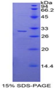 Mouse HDAC6 Protein (Recombinant His-T7)