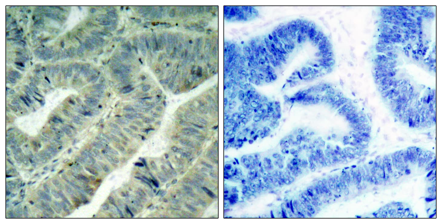 SRC Antibody (phospho-Tyr418)